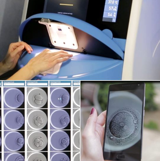 Descubre las 5 ventajas de EmbryoScope+, la novedosa tecnología en CIRH